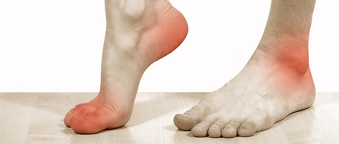Болят подошвы ног – этот симптом характерен для сотни заболеваний. Почему болят подошвы ног – что делать, как это вылечить - Автор Екатерина Данилова