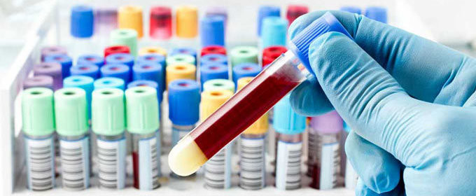 Причины повышенного железа в крови Повышенное железо в крови