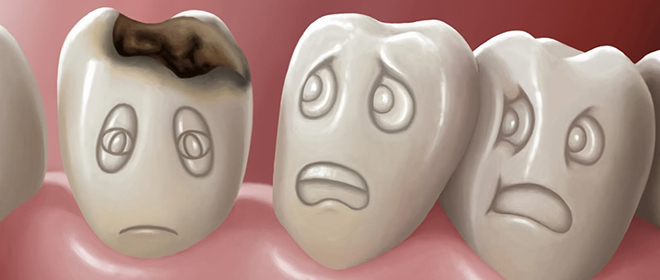 Как очистить зубы от кариеса Как очистить зубы от кариеса