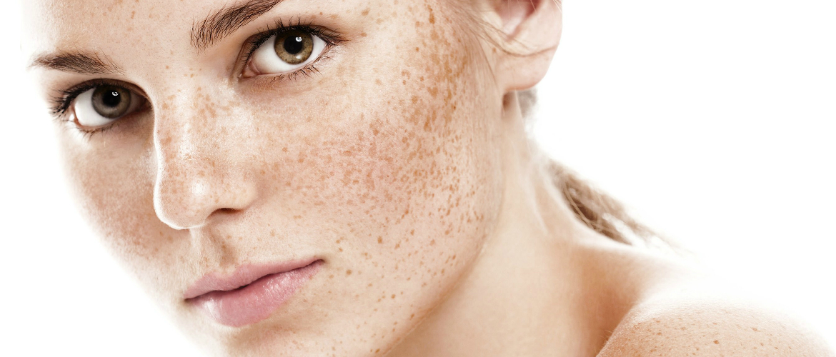 Лучшие средства от пигментных пятен на лице избавиться от пигментных пятен