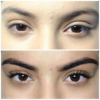 Ботокс ресниц: что это за процедура?