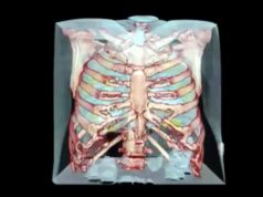 Поражение легких COVID-19 показали на видео