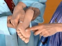 Как удалить натоптыши на ногах в домашних условиях