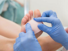 Натоптыши на ступнях: почему появляются? Симптомы и лечение