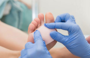 Натоптыши на ступнях: почему появляются? Симптомы и лечение