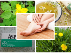 Народные средства от натоптышей и сухих мозолей — рецепты компрессов, мазей, ванночек