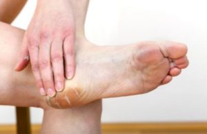 Натоптыши на пятках: фото того, как выглядит сухая мозоль и рекомендации, как её вылечить, в том числе как избавиться в домашних условиях и как убрать в клинике?