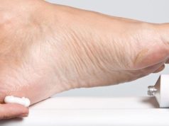 Как избавиться от натоптышей на ногах: самые эффективные средства