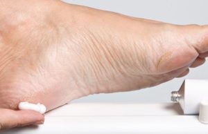 Как избавиться от натоптышей на ногах: самые эффективные средства