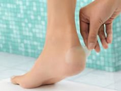 Как избавиться от натоптышей на ногах, чем лечить? Список самых современных средств