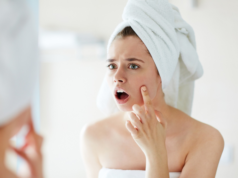 Как лечить прыщи, если у вас сухая кожа