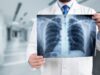Почему важно проходить флюорографию