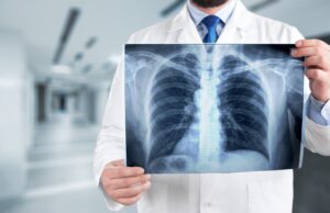 Почему важно проходить флюорографию