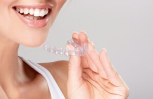 Преимущества выравнивания зубов элайнерами