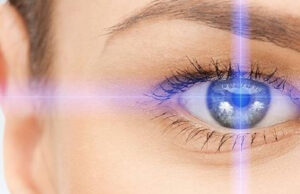 Коррекция астигматизма