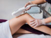 Лазерная эпиляция ног в Beauty Season