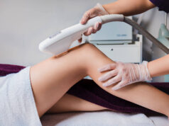 Лазерная эпиляция ног в Beauty Season