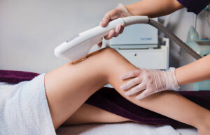 Лазерная эпиляция ног в Beauty Season