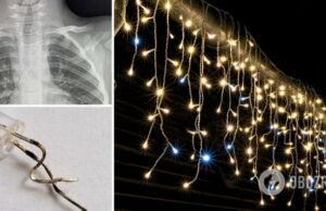Львовские медики достали из трахеи 4-летнего ребенка лампочку от гирлянды. Фото