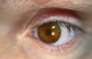 В Британии разработали технологию 3D-печати невероятно реалистичных глазных протезов