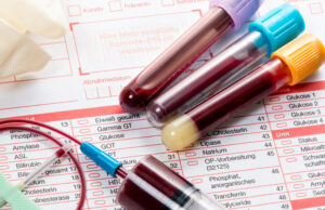 Быстрая сдача анализов на общие исследования