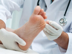 Как проходит удаление вросшего ногтя лазером?