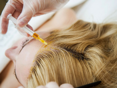 Чем помогает плазмотерапия волос