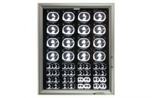 Особенности выбора негатоскопа