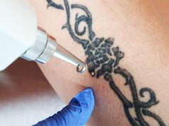 Сведение татуировки с лица