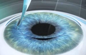 Какие наиболее распространенные заболевания глаз?