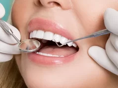 Что из себя представляет художественная реставрация зубов