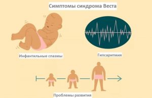 Синдром Веста: причины, лечение