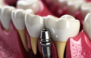 Влияние стоматологических услуг на общее здоровье и качество жизни пациентов