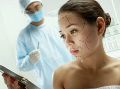 Блефаропластика азиатских век: особенности и результаты