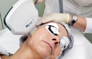 Фотоомоложение: что это такое, какого результата можно достичь