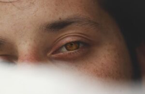 Значение родинки над левым глазом у женщин