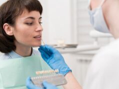 Установка виниров в домашних условиях: инструкция